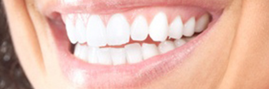 Zahnarzt Widmer Ästhetische Zahnheilkunde